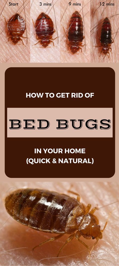 12 Easy Diy Ways To Get Rid Of Bed Bugs Quickly A Killer Guide Dengarden