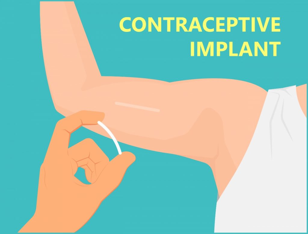 Male Birth Control: Effective Family Planning