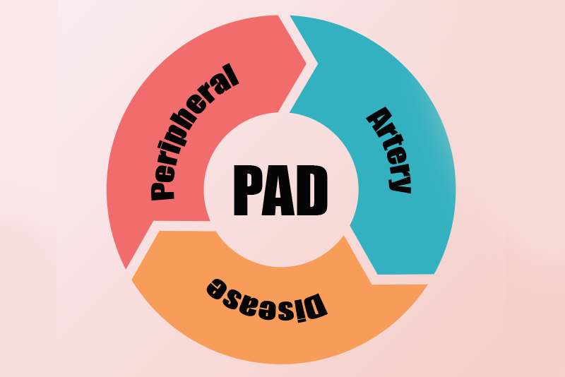 Peripheral Vascular Disease Icd 10