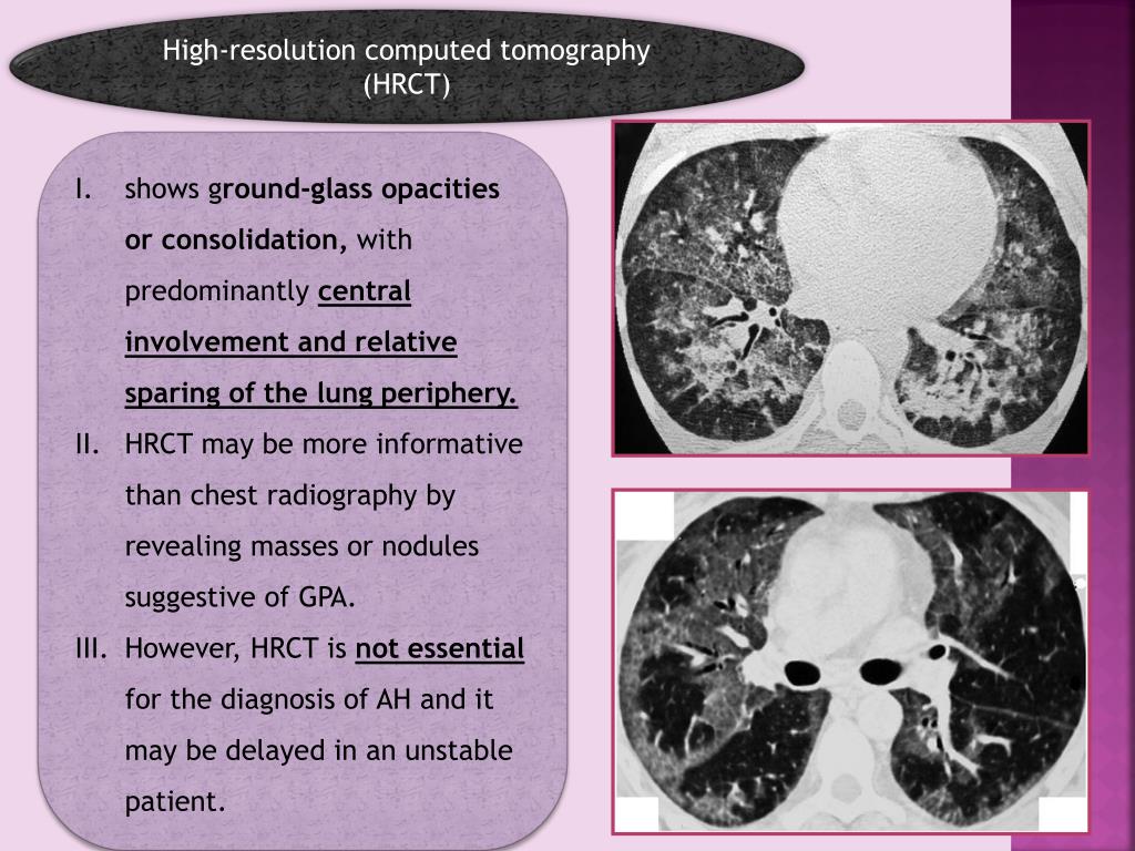 Ppt A Review Of Pediatric Syndromes Powerpoint Presentation Free