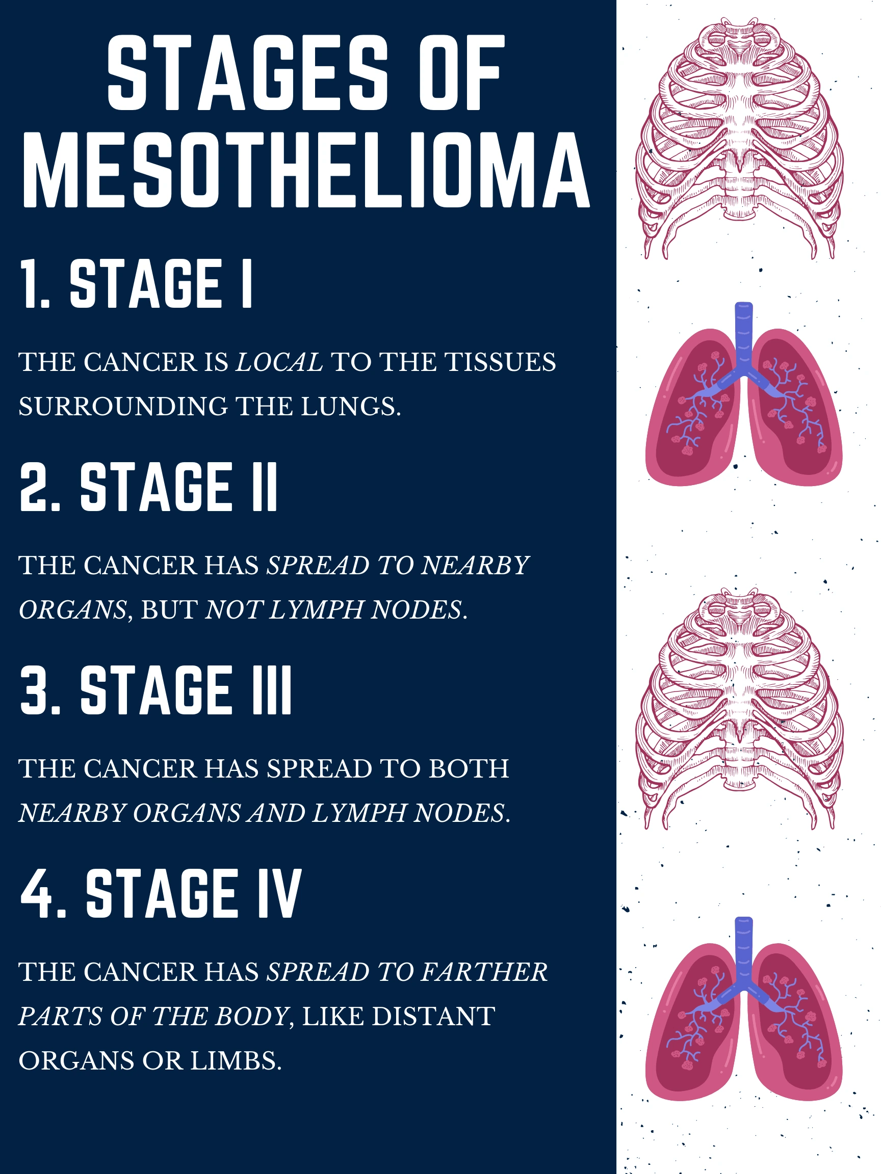 St. Louis Mesothelioma Lawyer Vimeo