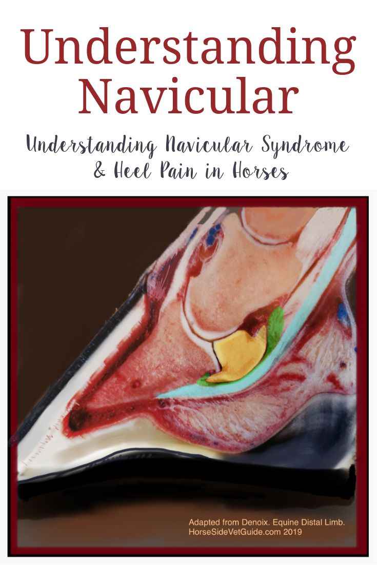 Understanding Navicular Syndrome In Horses Optiwize